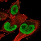 Immunofluorescent staining of human cell line U-251 MG shows localization to nucleoplasm & nucleoli fibrillar center.