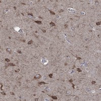 Anti-NCEH1 Antibody