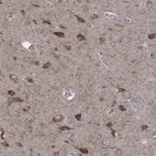 Anti-NCEH1 Antibody