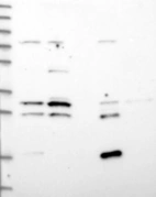Lane 1: Marker [kDa] 250, 130, 95, 72, 55, 36, 28, 17, 10 | Lane 2: RT4 | Lane 3: U-251 MG | Lane 4: Human Plasma | Lane 5: Liver | Lane 6: Tonsil