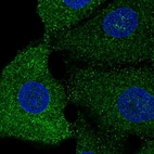 Anti-SREBF1 Antibody