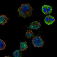 Anti-HORMAD2 Antibody