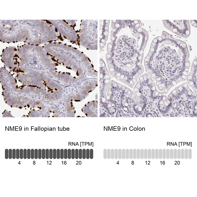 Anti-NME9 Antibody