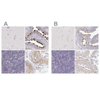 Immunohistochemical staining of human cerebral cortex, fallopian tube, lymph node and testis using Anti-NME9 antibody HPA043881 (A) shows similar protein distribution across tissues to independent antibody HPA040000 (B).