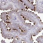 Immunohistochemical staining of human fallopian tube shows high expression.