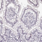 Immunohistochemical staining of human colon shows low expression as expected.