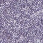Immunohistochemical staining of human lymph node using Anti-NME9 antibody HPA043881.