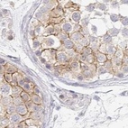 Immunohistochemical staining of human testis using Anti-NME9 antibody HPA043881.