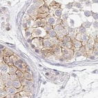Immunohistochemical staining of human testis using Anti-NME9 antibody HPA043881.