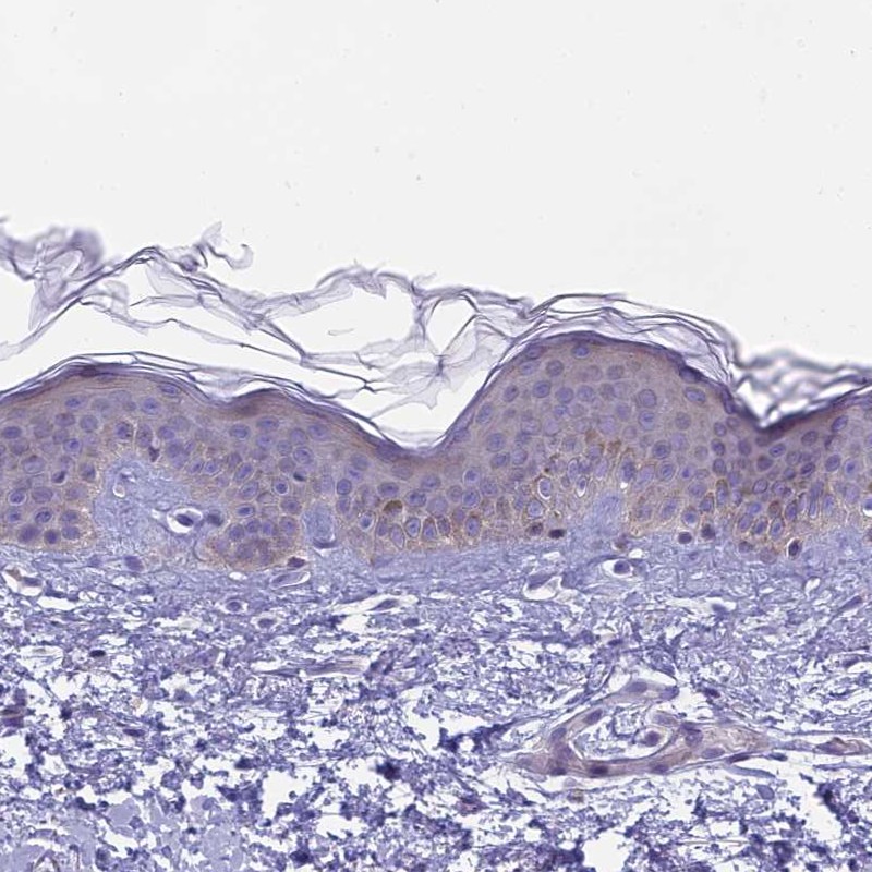 Anti-ARHGEF37 Antibody