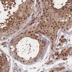 Anti-PSMA1 Antibody
