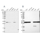 Western blot analysis using Anti-PSMA1 antibody HPA043891 (A) shows similar pattern to independent antibody HPA037646 (B).