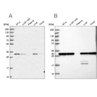 Western blot analysis using Anti-PSMA1 antibody HPA043891 (A) shows similar pattern to independent antibody HPA037646 (B).