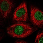 Immunofluorescent staining of human cell line A-431 shows localization to nucleoplasm.