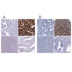 Immunohistochemical staining of human endometrium, heart muscle, pancreas and prostate using Anti-MYBPC3 antibody HPA043898 (A) shows similar protein distribution across tissues to independent antibody HPA040147 (B).