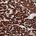 Immunohistochemical staining of human heart muscle shows strong cytoplasmic positivity in cardiomyocytes.