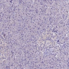 Immunohistochemical staining of human pancreas shows no positivity in exocrine glandular cells as expected.