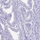 Immunohistochemical staining of human endometrium shows no positivity in glandular cells as expected.