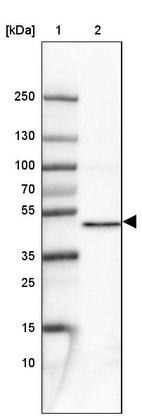 Lane 1: Marker [kDa] 250, 130, 100, 70, 55, 35, 25, 15, 10_br/_Lane 2: Human cell line CACO-2