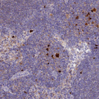 Anti-PCED1B Antibody