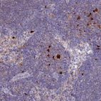 Anti-PCED1B Antibody