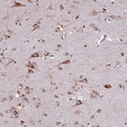 Anti-PACSIN3 Antibody