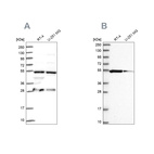 Western blot analysis using Anti-PACSIN3 antibody HPA043904 (A) shows similar pattern to independent antibody HPA039480 (B).
