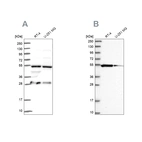 Western blot analysis using Anti-PACSIN3 antibody HPA043904 (A) shows similar pattern to independent antibody HPA039480 (B).