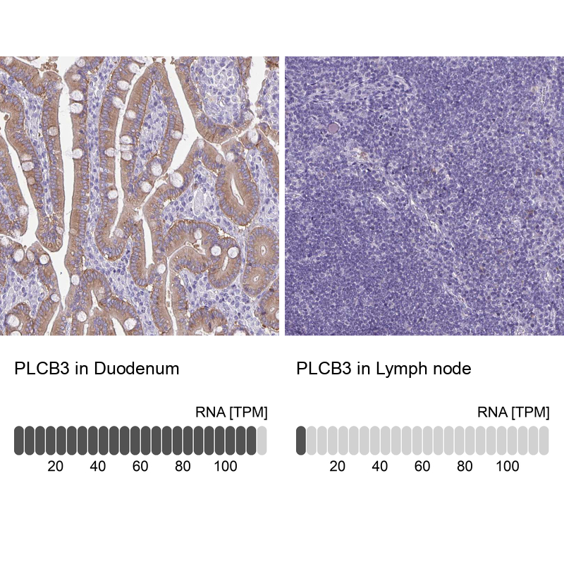 Anti-PLCB3 Antibody