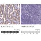 Anti-PLCB3 Antibody