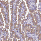 Anti-PLCB3 Antibody