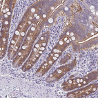 Immunohistochemical staining of human small intestine shows moderate cytoplasmic positivity in glandular cells.