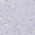Immunohistochemical staining of human cerebral cortex shows no positivity in neurons as expected.
