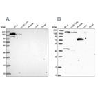 Western blot analysis using Anti-PLCB3 antibody HPA043907 (A) shows similar pattern to independent antibody HPA039279 (B).