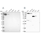Western blot analysis using Anti-PLCB3 antibody HPA043907 (A) shows similar pattern to independent antibody HPA039279 (B).