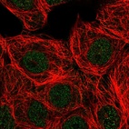 Immunofluorescent staining of human cell line MCF7 shows localization to nucleoplasm.