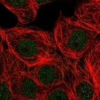 Immunofluorescent staining of human cell line MCF7 shows localization to nucleoplasm.