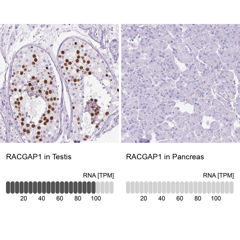 Anti-RACGAP1 Antibody