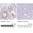 Anti-RACGAP1 Antibody