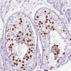 Immunohistochemical staining of human Testis shows strong nuclear positivity in spermatocytes and spermatids.