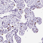 Immunohistochemical staining of human Placenta shows strong nuclear positivity in trophoblastic cells.