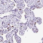 Immunohistochemical staining of human Placenta shows strong nuclear positivity in trophoblastic cells.