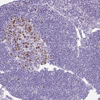 Immunohistochemical staining of human Lymph node shows moderate nuclear positivity in germinal center and non-germinal center cells.