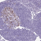 Immunohistochemical staining of human Lymph node shows moderate nuclear positivity in germinal center and non-germinal center cells.