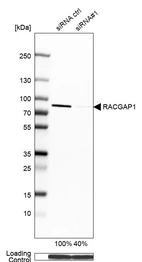 Western blot analysis in A-431 cells transfected with control siRNA, target specific siRNA probe #1, using Anti-RACGAP1 antibody. Remaining relative intensity is presented. Loading control: Anti-GAPDH.