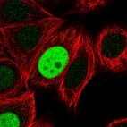 Immunofluorescent staining of human cell line MCF7 shows localization to nucleoplasm.