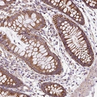 Anti-CEP290 Antibody