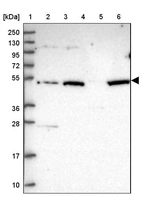 Lane 1: Marker [kDa] 250, 130, 95, 72, 55, 36, 28, 17, 10_br/_Lane 2: Human cell line RT-4_br/_Lane 3: Human cell line U-251 MG_br/_Lane 4: Human plasma_br/_Lane 5: Human Liver tissue_br/_Lane 6: Human Tonsil tissue