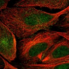 Immunofluorescent staining of human cell line U-2 OS shows localization to nucleoplasm & vesicles.