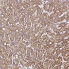 Immunohistochemical staining of human liver shows strong granular cytoplasmic positivity in hepatocytes.